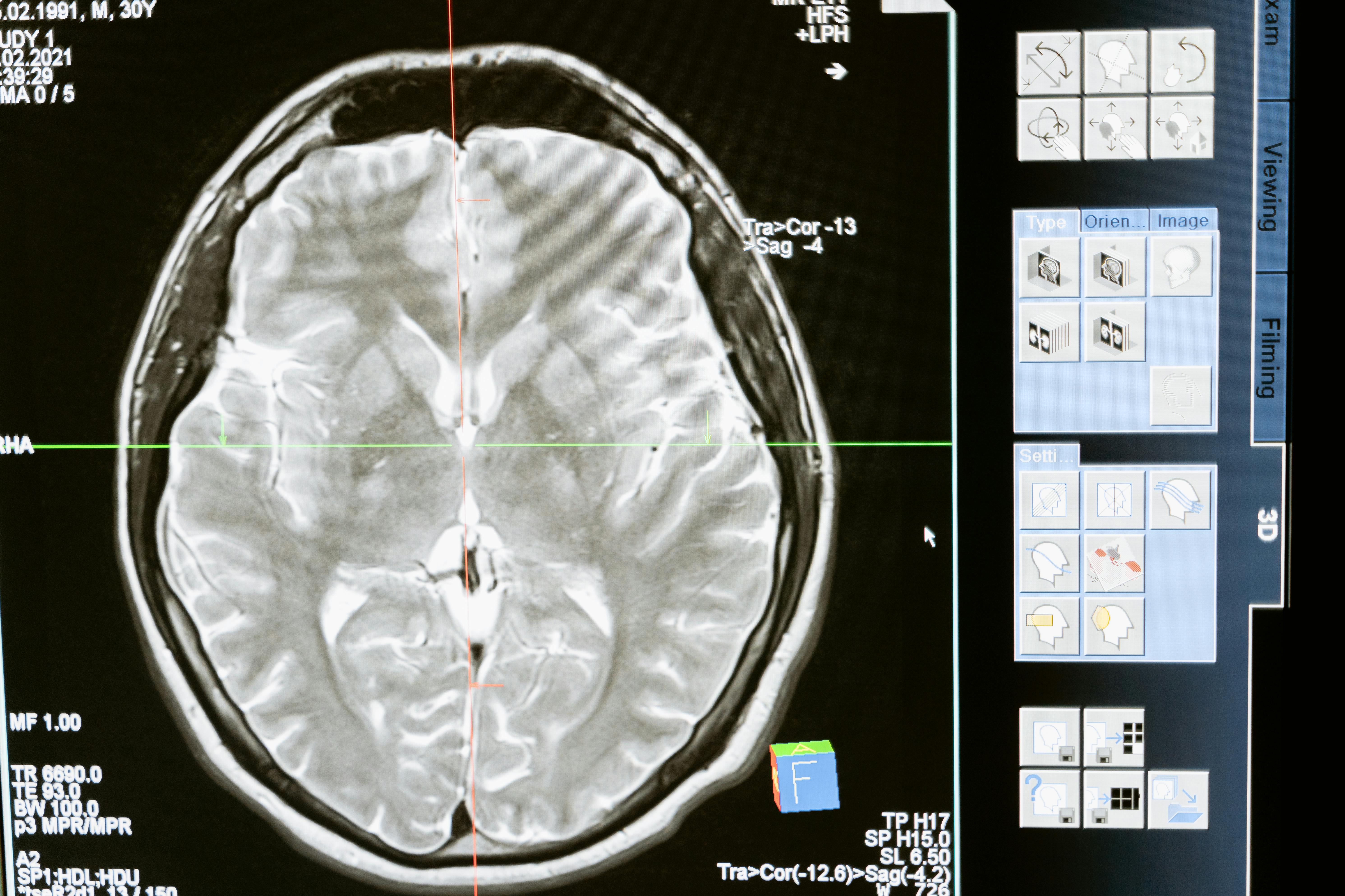 The Human Brain: Complexity in Thought and Experience